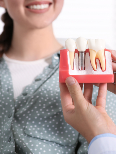 dental implant banner