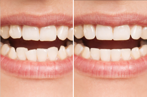 before after img 3