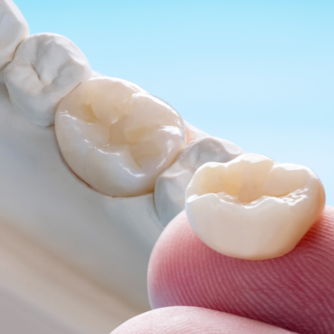 dental crown banner