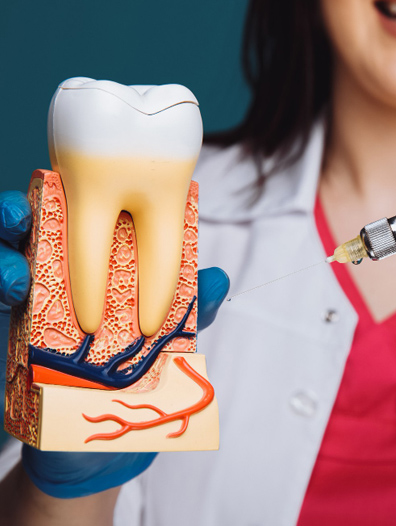 root canal treatment 2