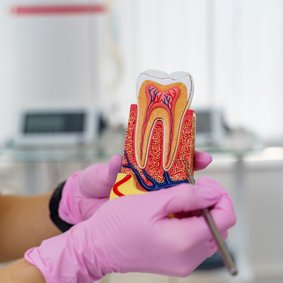 root canal treatment banner