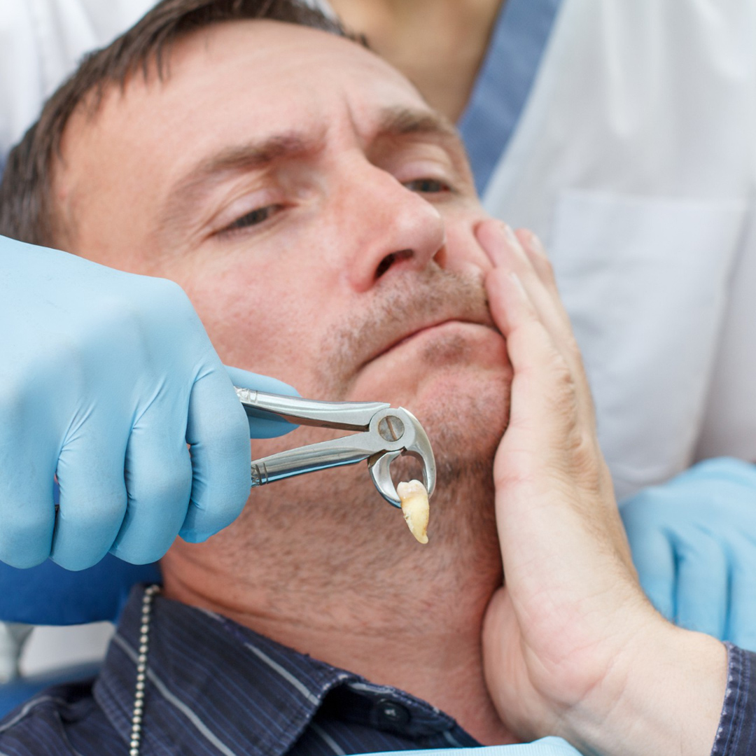 tooth extraction banner